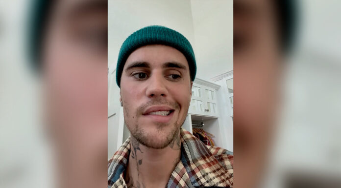 justin-bieber-sindrome-de- Ramsay-Hun